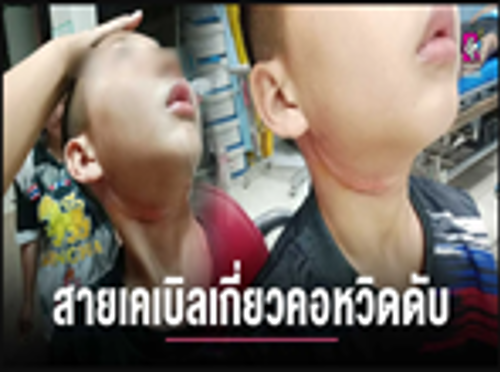 สำนักงาน กสทช. เขต 32 ประสานแก้ไขปัญหาเรื่องร้องเรียนอุบัติเหตุสายสื่อสาร ตามข้อมูลที่ปรากฏบนสื่อออนไลน์